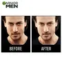 Garnier Men Acno Fight Pimple Clearing Whitening Day Cream 45g, 4 image