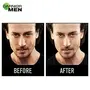 Garnier Men Acno Fight Pimple Clearing Whitening Day Cream 45g, 6 image