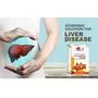 Livalthy Ayurvedic Medicine for helps fatty liver I Liver Protection l Liver Cleanse l Liver Detox (60caps), 3 image