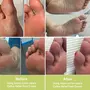 Azani Callus Relief Foot Cream - 100g | 25% Urea Castor & Tea Tree Oil | Callus & Corns remover Deeply moisturizes extreme Dry Rough Feet Cracked heel | Exfoliates Dead skin| Women & Men, 8 image