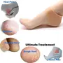 Unisex Vented Moisturizing Silicone Gel Heel Socks for Swelling Pain Relief Foot Care Ankle Support Pad (Skin Colour), 4 image