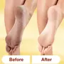 KAZARMAA Heal & Repair Lemon Foot Cream For Cracked Heels With Shea Butter Vitamin-E Coconut Oil And Jojoba Oil For Soft Feet - 100G, 4 image