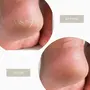 Lass Naturals Foot Care Cream | Advanced cracked heel cream Ayurvedic Formula for Healing & Soothing of Cracked Heals Feet cream is an ayurvedic paraben-free sulphate-free foot cream100 g | Skin Care, 6 image