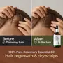 Aravi Organic Rosemary Essential Oil for Hair Growth Hair Fall Control and Nourishment Skin Care - 100% Pure Natural and Undiluted - 30 ml, 3 image