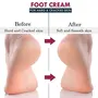 7 Fox Foot Cream For Rough Dry and Cracked Heel | Feet Cream For Heel Repair |Healing & softening cream for Women & Men 100gm, 5 image