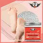 7 Fox Foot Cream For Rough Dry and Cracked Heel | Feet Cream For Heel Repair |Healing & softening cream for Women & Men 100gm, 2 image