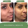 Mystiq Living  Blemish Clear Face Scrub for De Tan Dark Spot Removal Anti Pigmentation Skin Brightening & Glowing Skin | Ayurvedic Formulation - 100 GM, 17 image