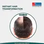 Dr. Batra's Instant Hair Natural Keratin Hair Building Fibre Dark Brown 12g, 2 image